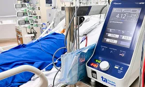 Sốc tim sau 4 ngày sốt siêu vi